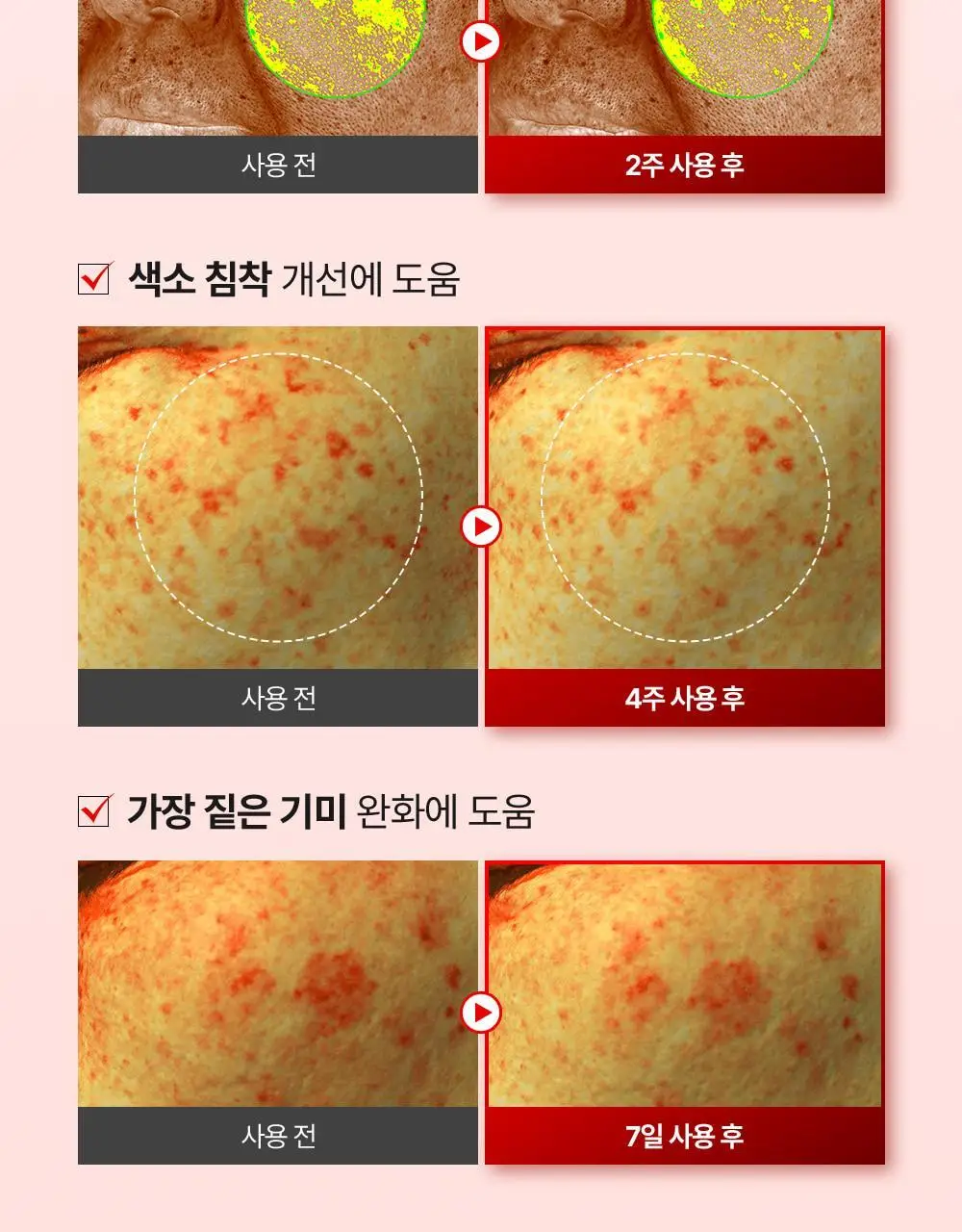 [기미잡티] 메디필 멜라논엑스 앰플 RX 30ml 상세페이지 31